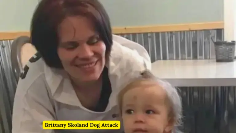 Brittany Skoland Dog Attack