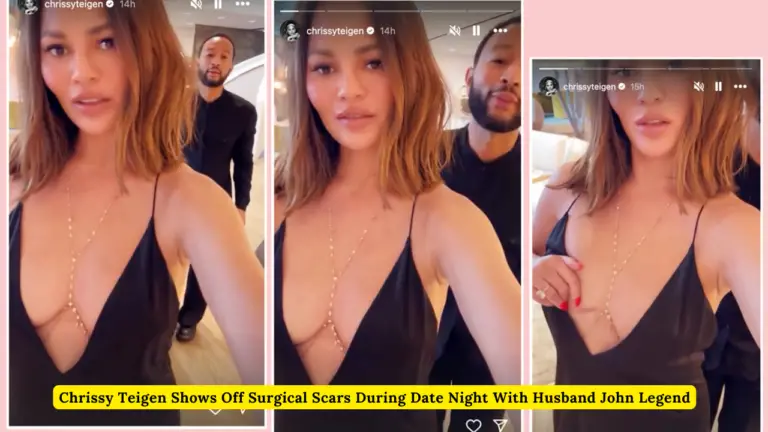 Chrissy Teigen Shows Off Surgical Scars During Date Night With Husband John Legend