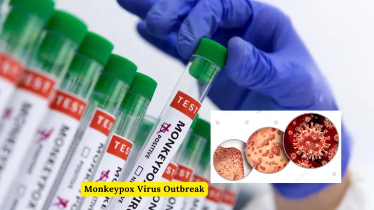 Monkeypox Virus Outbreak