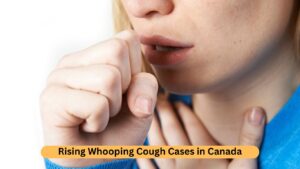 Rising Whooping Cough Cases in Canada